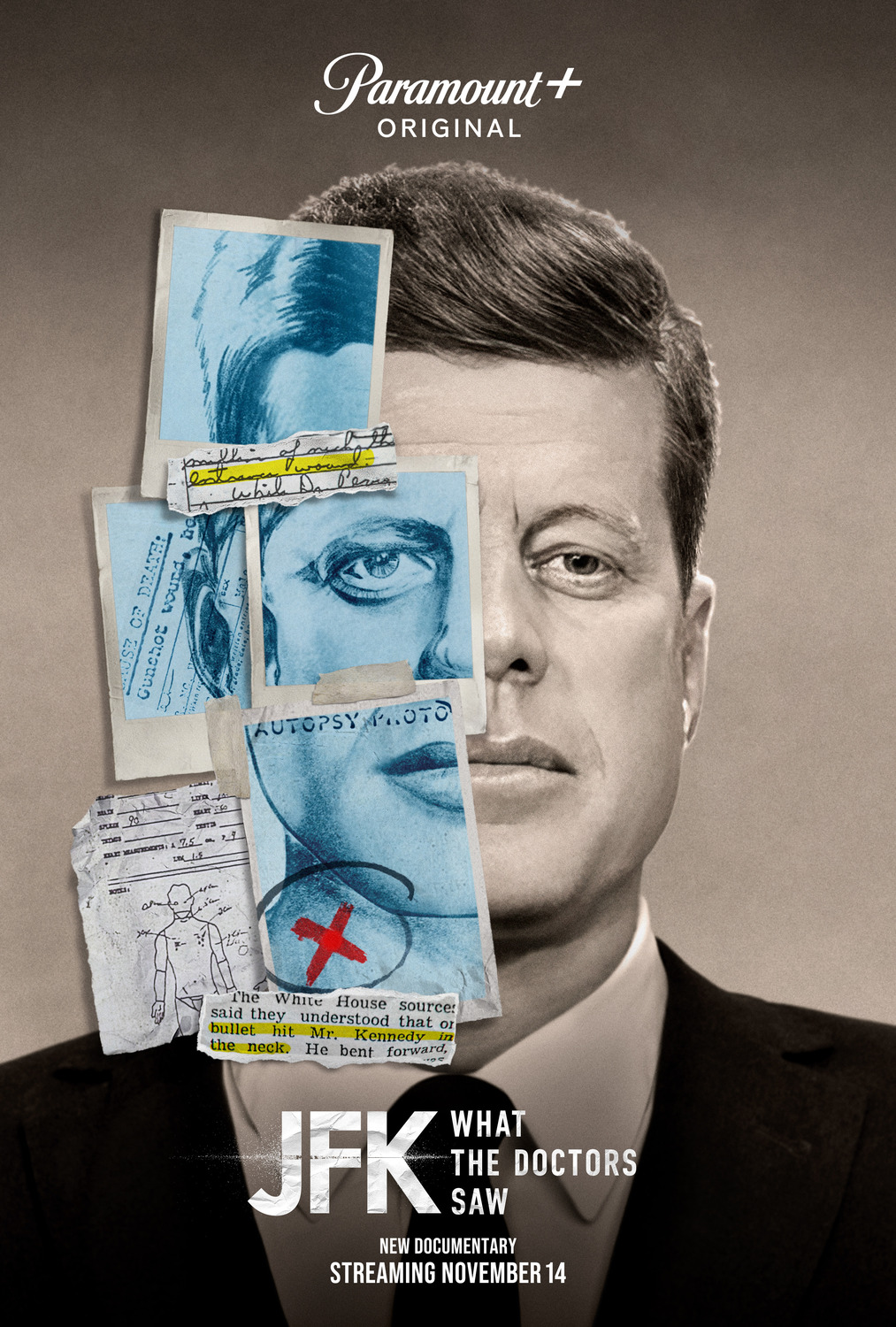 Extra Large Movie Poster Image for JFK: What the Doctors Saw 