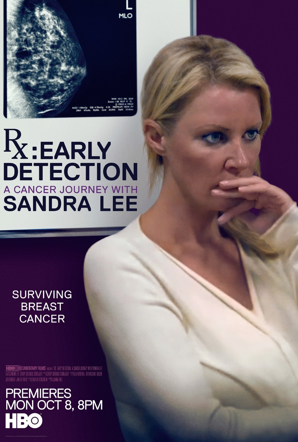 Extra Large TV Poster Image for RX: Early Detection - A Cancer Journey with Sandra Lee 